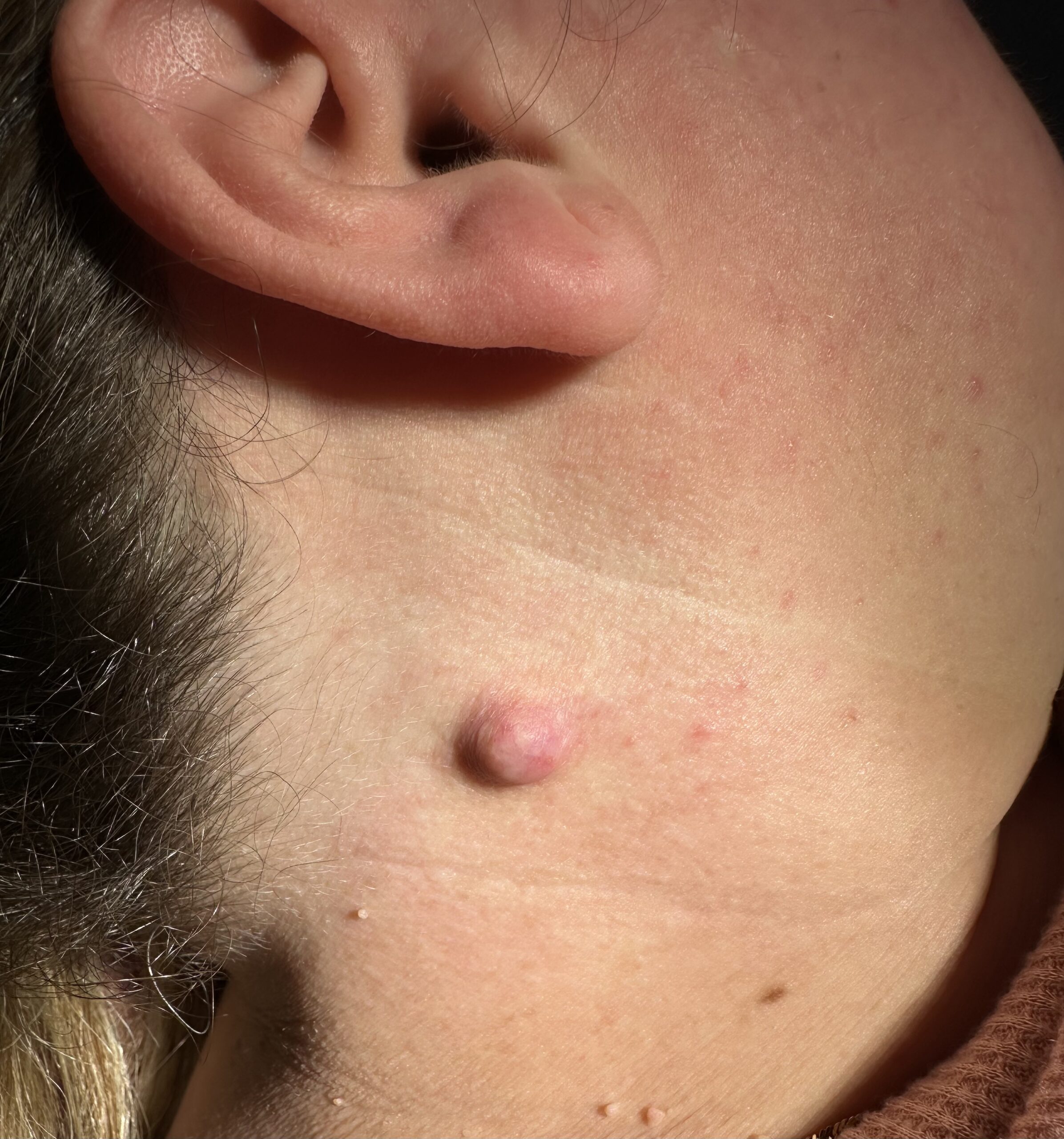 Mole Before Mole Before